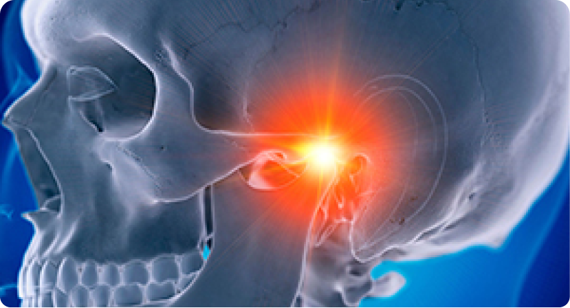 [SSG] Management of Temporomandibular Disorders