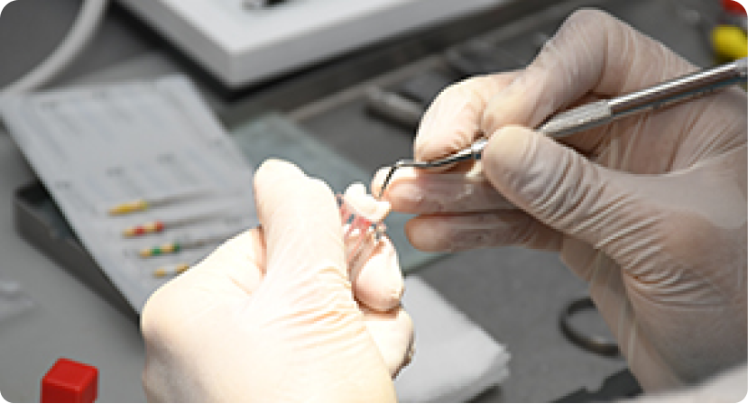 [SSG] Restorative Workshop Series 2: Restoring Tooth, from Apex to Crown (2nd Run)