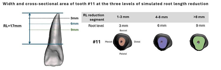 Beyond Root Length: New Research Reveals Crucial Insight for Long-Term Tooth Stability